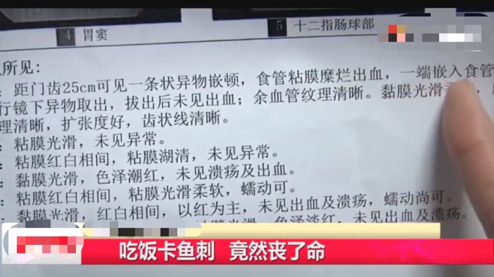 男子鱼刺卡喉5个多小时才就医的背后故事