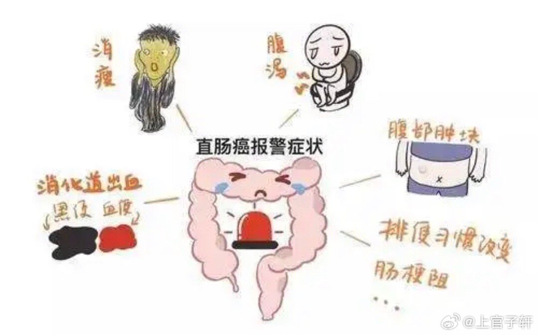 腹泻几天确诊结肠癌，揭示早期症状与防治的重要性